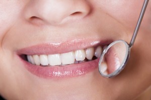 Smiling woman with perfect teeth