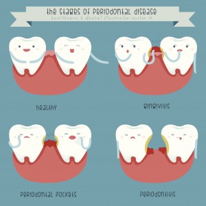 gum disease