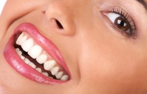 teeth whitening