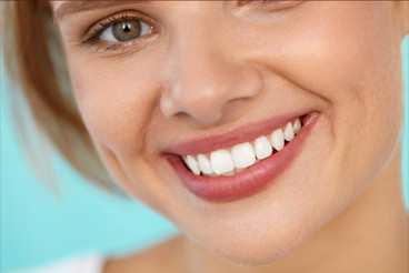porcelain veneers indianapolis
